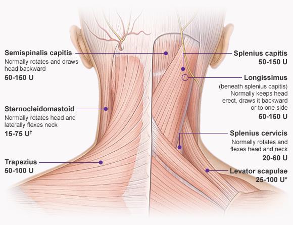 Occasional headaches and dizziness